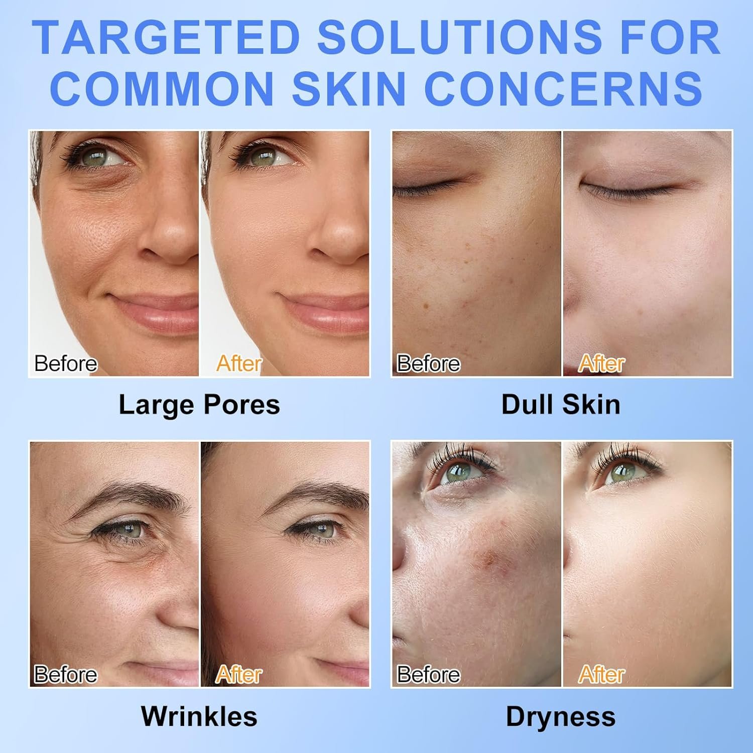 Bio Collagen Face Mask 6pcs, Intense Hydration, Reduce Fine Lines & Wrinkles, Soothing & Hydrating Overnight Hydrogel Mask - Image 7