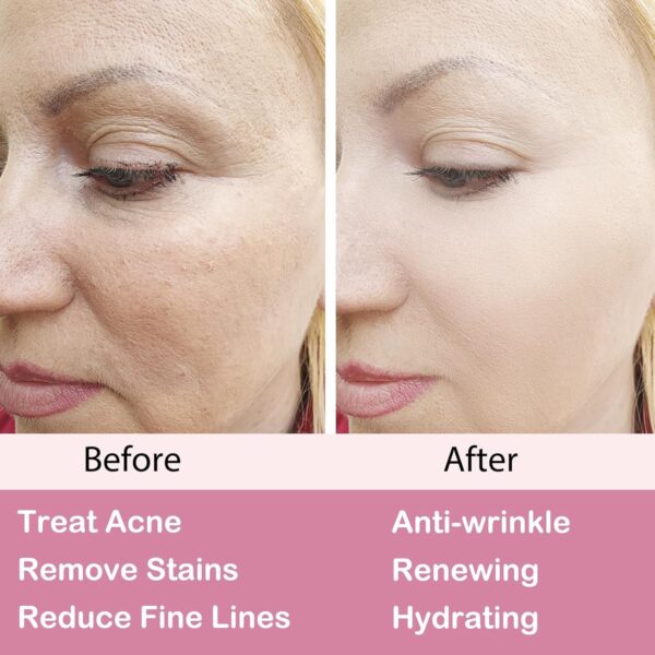 Retinol Moisturizer Cream,For Face&Eye Area Anti Aging Wrinkles & Acne & Fine Lines - With 2.5% Active Retinol (50Milliliter) - Image 5
